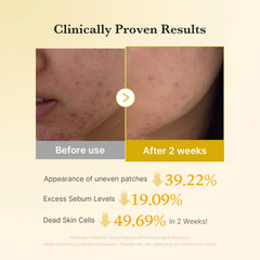 [GIFT] Kojic Acid Tumeric Toner Pad